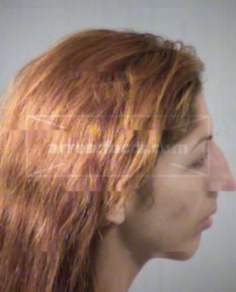 Lyndsy Diean Ritchie