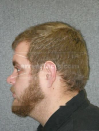 Joseph J Scherer