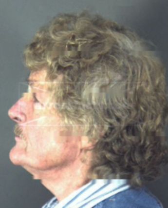 William Norman St. Charles