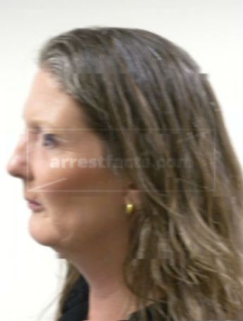 Judiann Terpstra
