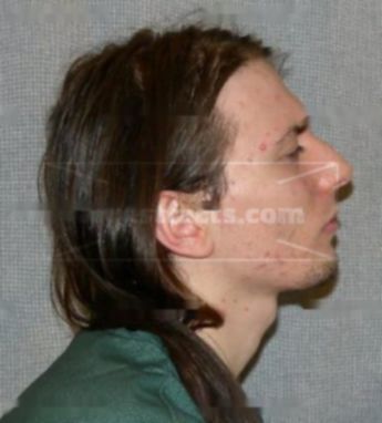 Matthew P Schmidt
