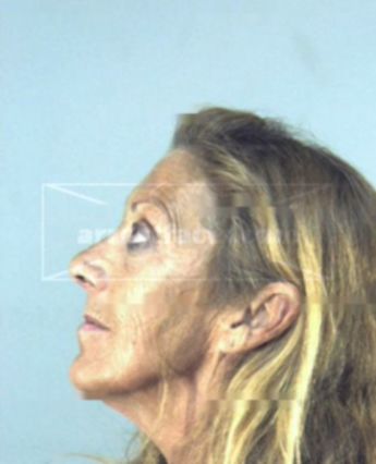 Betty June Woods