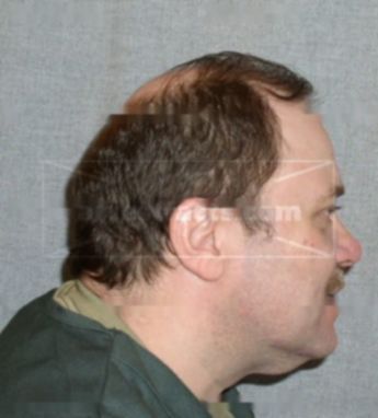 Mark A Hochleutner