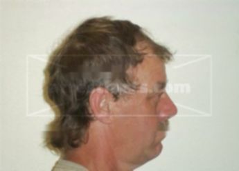 Harold J Oliver