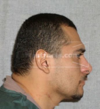 Hilario Espinoza
