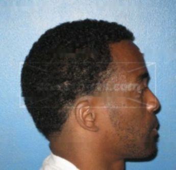 Michael Thurmond