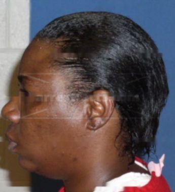 Yvette R Johnson