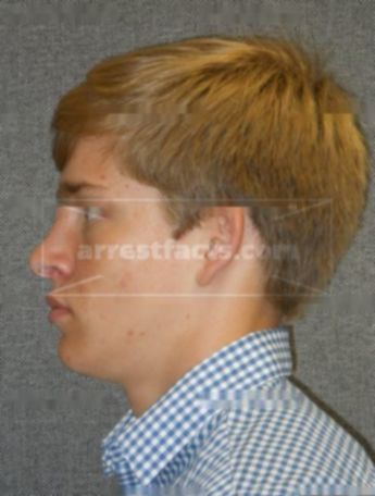 Logan G Schwebs