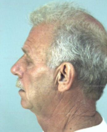 Louis Wayne Simpson