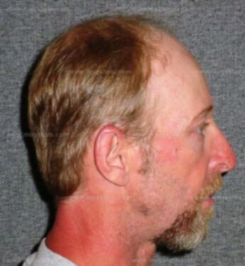 Randall S Lehman