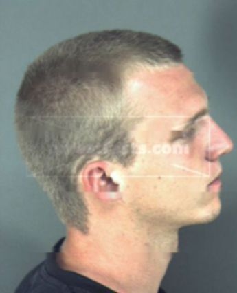 Todd Allen Million