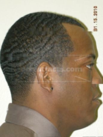 Lonzo D Dixon