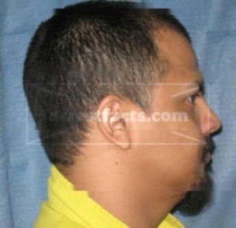 Alejandro Rojas