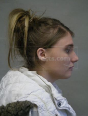 Nicole L Harms