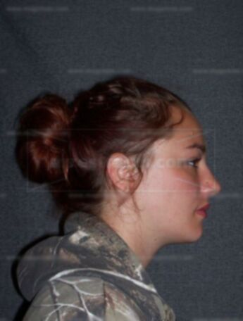 Brooke L Grathwol