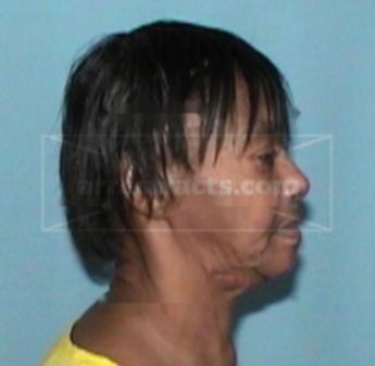 Sharon L Hollester