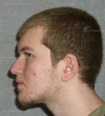 Nicholas L Enerson