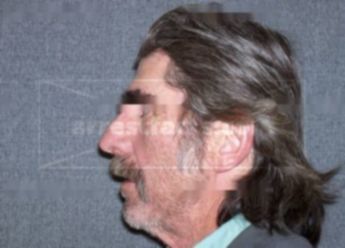 Richard D Bradley