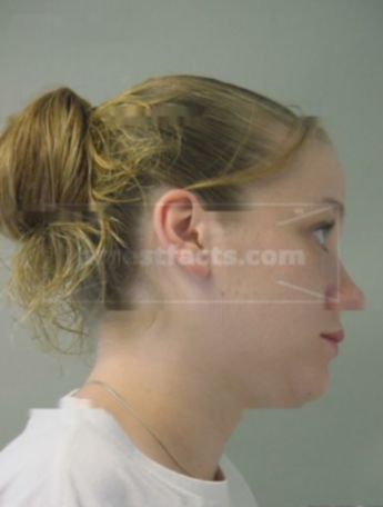 Melissa S Fredrick