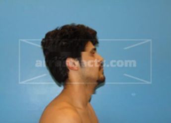 Bryan Fonseca