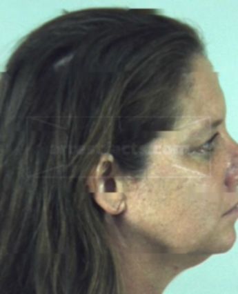 Robin Lynn Kern