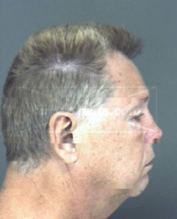 William Earl Strain