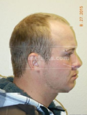 Jason J Deruyter