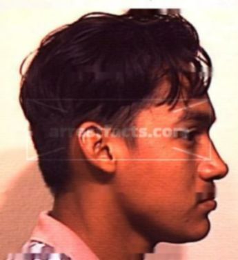 Jose Antonio Artunez