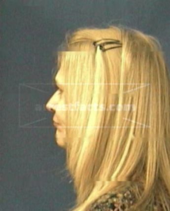 Carol D Phillips