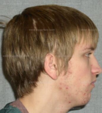 Tyler J Brandenburg
