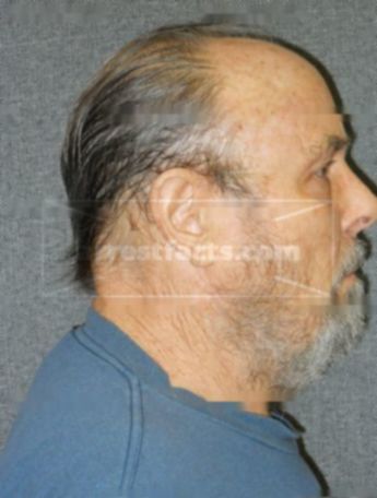 Ronald B Dahl