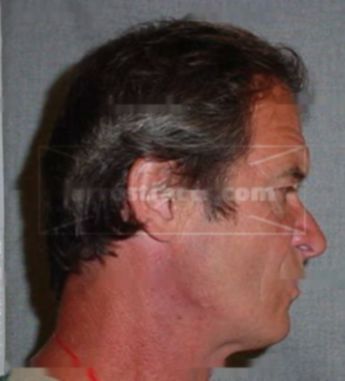 Jon A Hudak