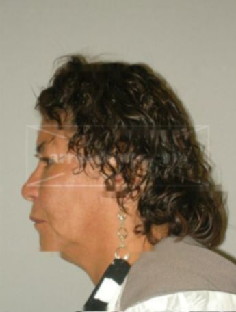 Rosanne Peterson