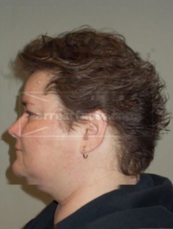 Kathy A Dankert