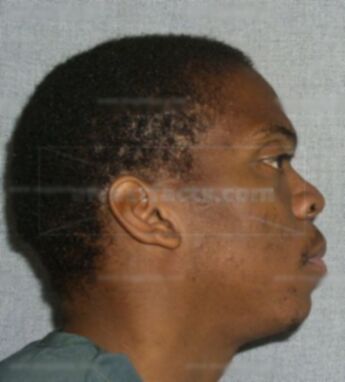 Darrell D Garrett