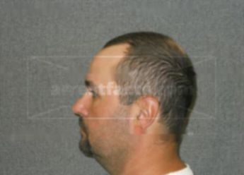 Gary L Baumann