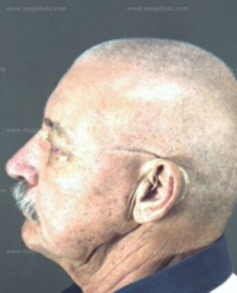 Elmer Morris