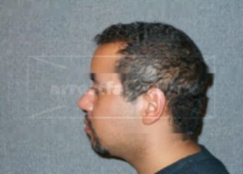 Marlon L Levi