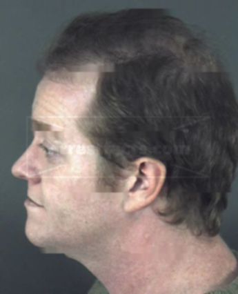 Michael William Barron