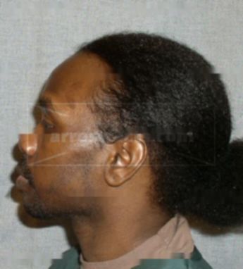 Tremain L Gilmore