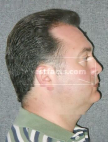 Paul D Fromandi