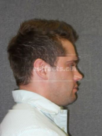 Jacob M Zwiebel