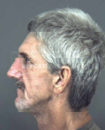 Thomas Mendel Glisson