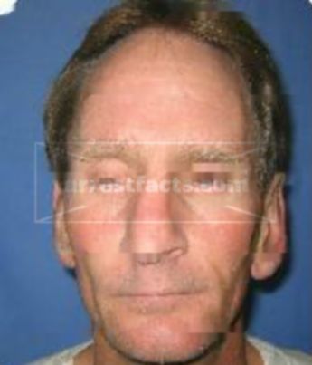 Keven Wade Castleberry