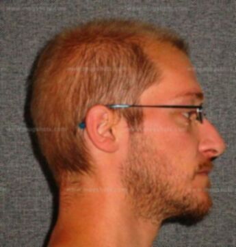 Joshua A Frazee