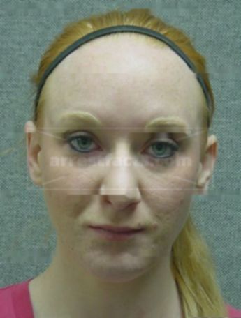 Heather R Burnheimer