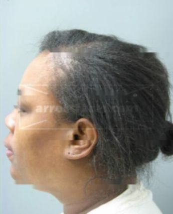 Hattie Clemons