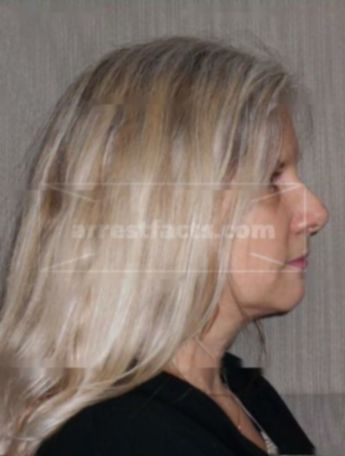 Lynn M Gerrits