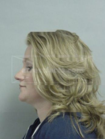 Tracy L Erke