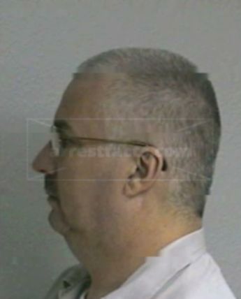 Anthony M Hurst